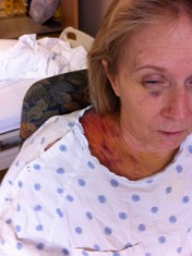 2011-05-20-Janeen's TBI-31.jpg